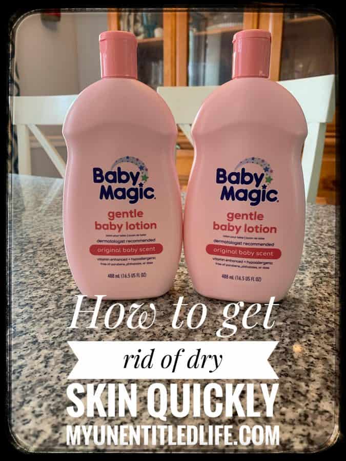 how to get rid of dry skin quickly